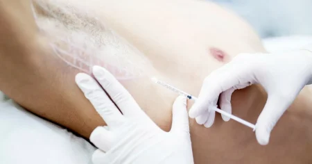 Apotek misstänks ha lurat tio regioner på miljonbelopp – för falska svettbehandlingar