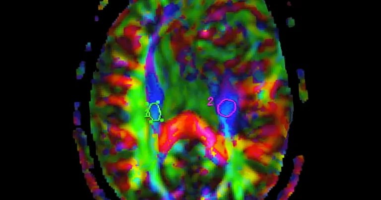 Lovande resultat för behandling av dödlig hjärntumör