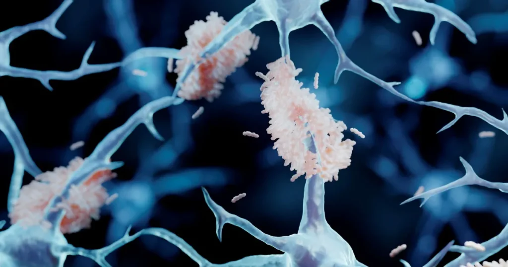 Nya läkemedel mot alzheimers sågas i ny rapport