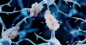 Nya läkemedel mot alzheimers sågas i ny rapport