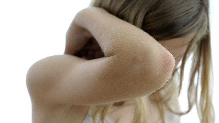 Bris: Barn mer utsatta under sommarlovet