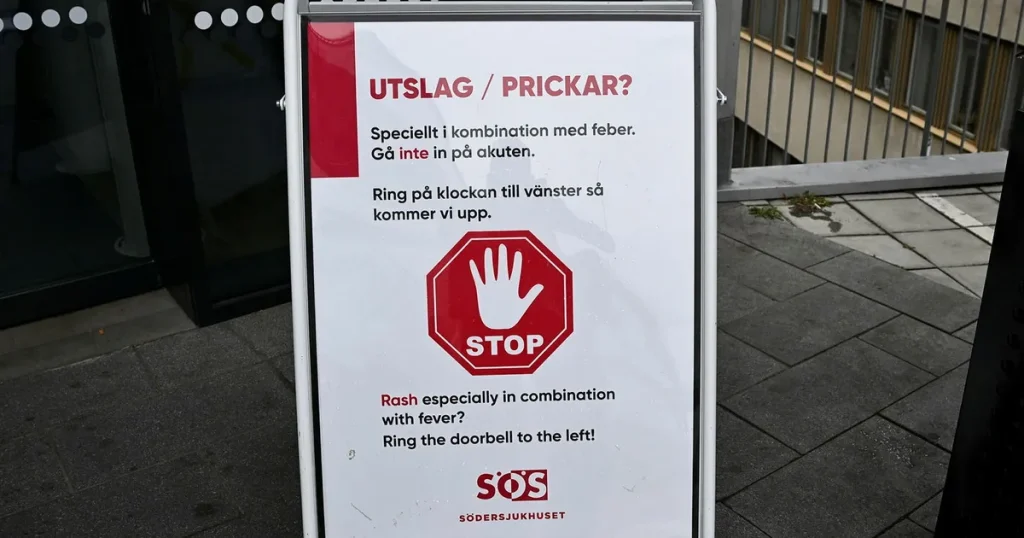Tusentals svenskar saknar fullgott skydd mot mässling – trots vaccin
