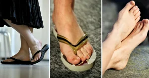 Experter om när tårna får synas: ”Då är det ohygienskt”