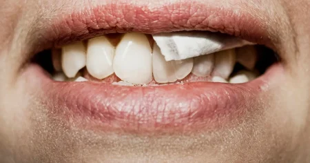 Så påverkas din hud av vitt snus – från rynkor till torrhet